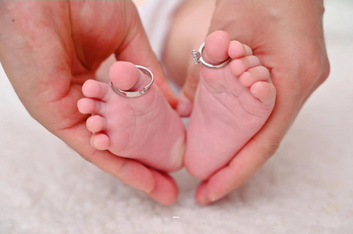 徐州孕妇怎样预防妊娠纹